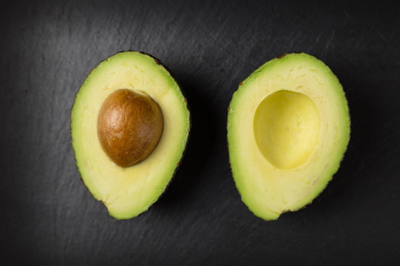 10 Reasons Why You Should Be Eating An Avocado Every Day